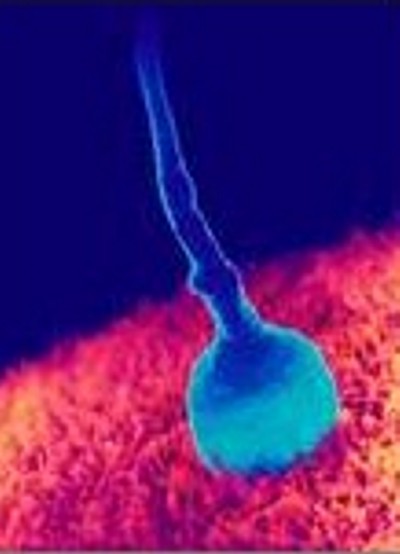 SON_000_EGG_SPERM_ATTEMPT.jpg (28876 bytes)