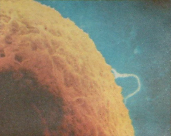 spermatozoid ulazi u jajnu celiju1.jpg (47455 bytes)