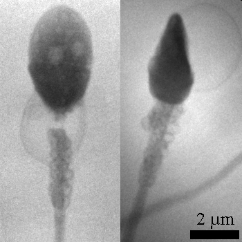 2_sperm.gif (116678 bytes)