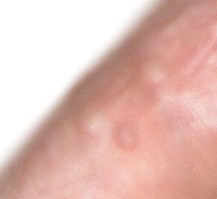 EGG_SHELL_IN_SKIN2.jpg (6840 bytes)