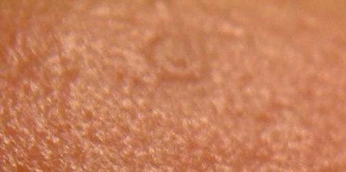 EGG_SHELL_IN_SKIN_FOREHEAD_LEFT2.jpg (28004 bytes)
