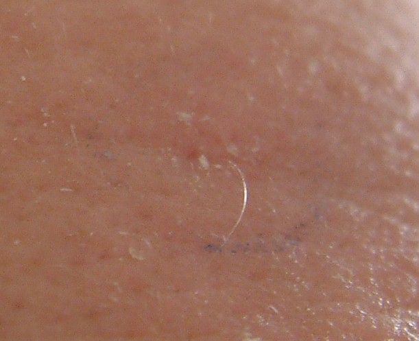 HAIR_ANTENNA_IN_FOREHEAD.jpg (56197 bytes)