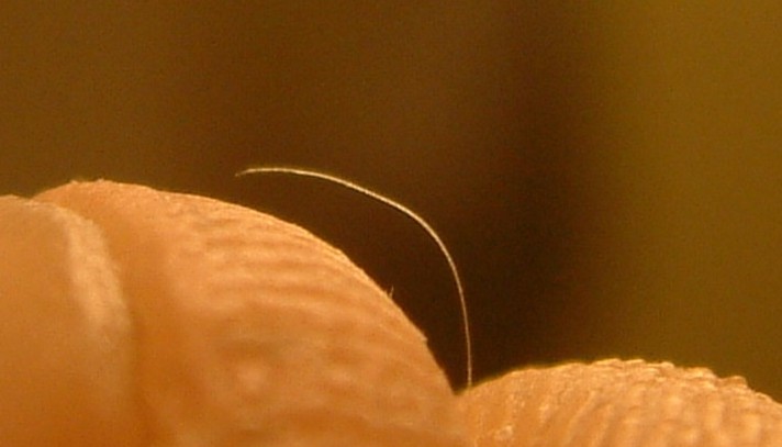HAIR_ANTENNA_REMOVED_FROM_FOREHEAD_SMALL.jpg (41972 bytes)