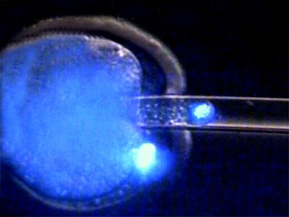 HUMAN_EGG_ARTIFICIAL_INSEMINATION_NEGATIVE.jpg (25612 bytes)