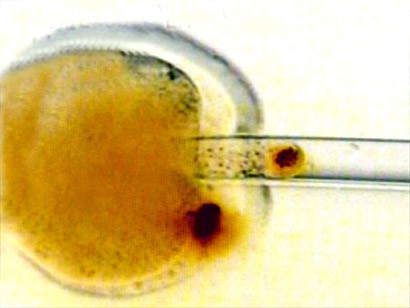 HUMAN_EGG_ARTIFICIAL_INSEMINATON_POSITIVE.jpg (25636 bytes)