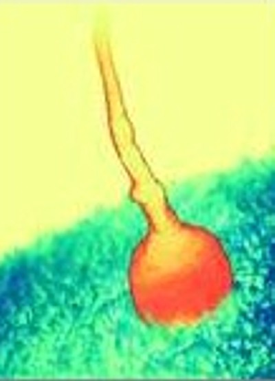 SON_000_EGG_SPERM_ATTEMPT1.jpg (28909 bytes)