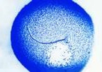 SON_000_HUMAN_FEMALE_EGG_SPERM VISIBLE_TAIL_NEGATIVE.jpg (27811 bytes)