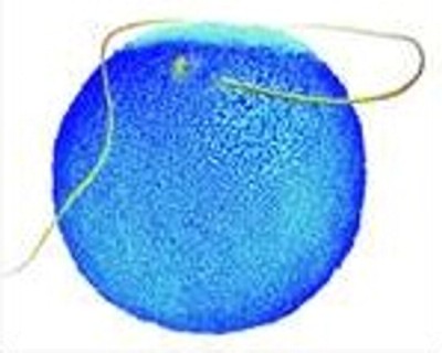 SON_000_HUMAN_FEMALE_EGG_SPERM VISIBLE_TAIL_NEGATIVE_1.jpg (24800 bytes)