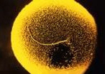 SON_000_HUMAN_FEMALE_EGG_SPERM VISIBLE_TAIL_POSITIVE.jpg (27798 bytes)