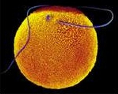 SON_000_HUMAN_FEMALE_EGG_SPERM VISIBLE_TAIL_POSITIVE_1.jpg (24774 bytes)