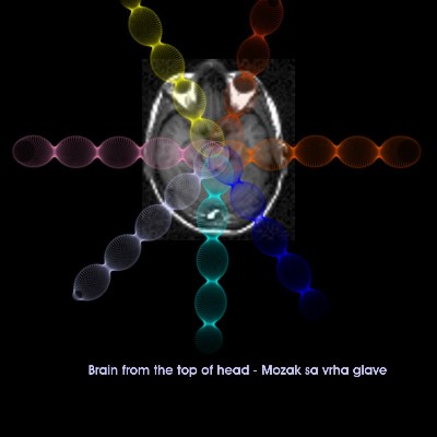 Brain_axial_MRI_invisible_beams_TOPHEAD_400.jpg (20238 bytes)