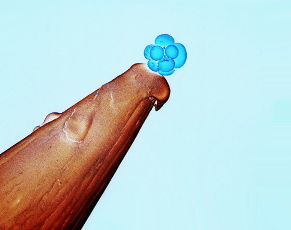 HUMAN EMBRIO AT THE 16 cell STAGE ON THE TIP OF PIN
